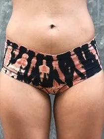 Fire Cheeky Bottoms